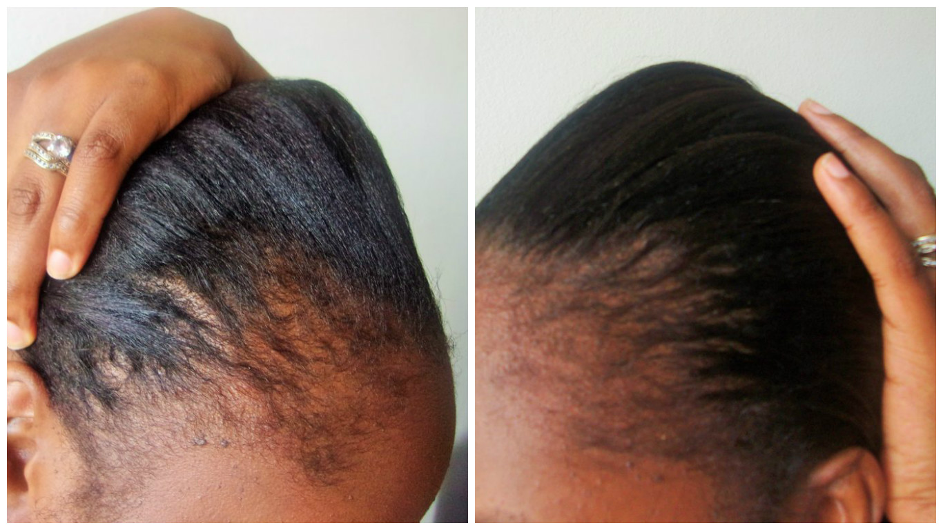 Castor Oil In Hair.